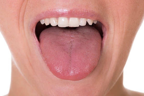 Основні симптоми нальоту на язику